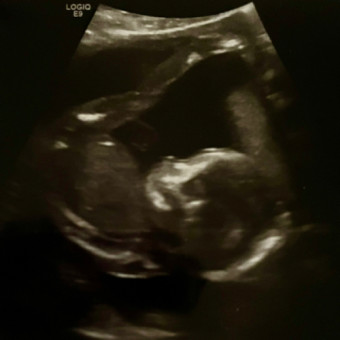 Babylist Registry Photo.