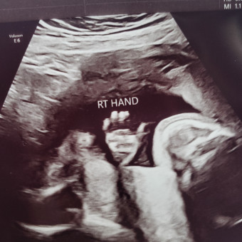 Babylist Registry Photo.