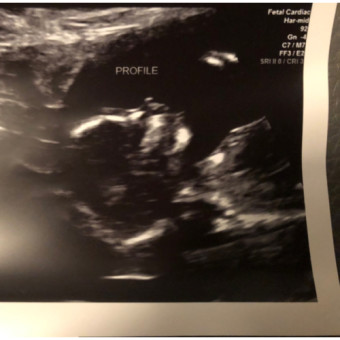 Babylist Registry Photo.