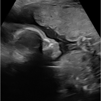 Babylist Registry Photo.