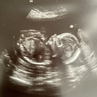 Babylist Registry Photo.