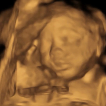 Babylist Registry Photo.