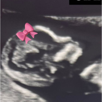 Babylist Registry Photo.