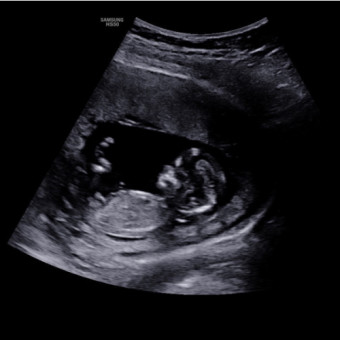 Babylist Registry Photo.