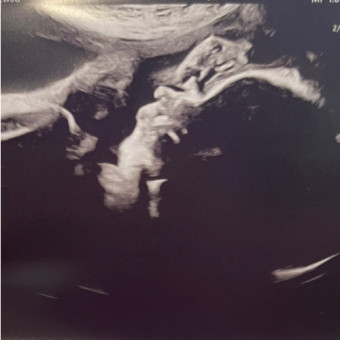 Babylist Registry Photo.