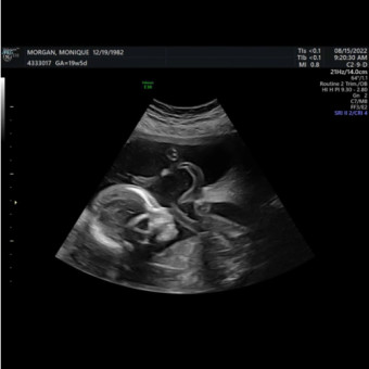 Babylist Registry Photo.