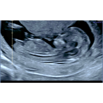 Babylist Registry Photo.
