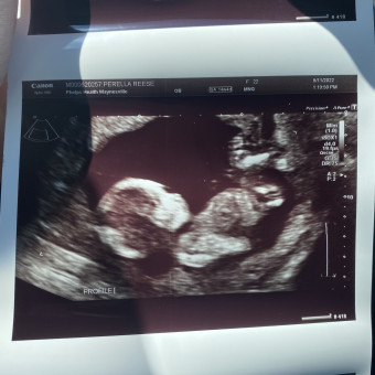 Babylist Registry Photo.