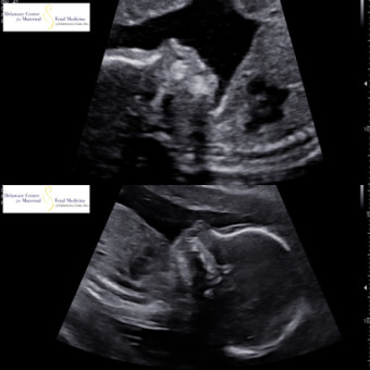 Babylist Registry Photo.