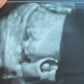 Babylist Registry Photo.