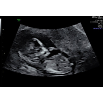 Babylist Registry Photo.
