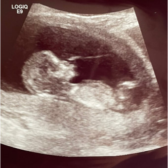 Babylist Registry Photo.