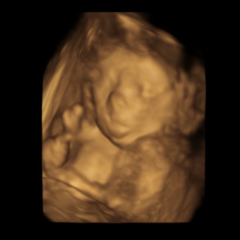 Babylist Registry Photo.