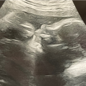 Babylist Registry Photo.