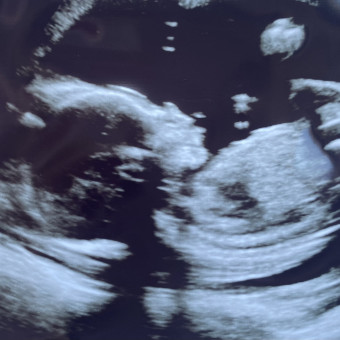 Babylist Registry Photo.
