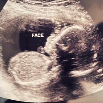 Babylist Registry Photo.