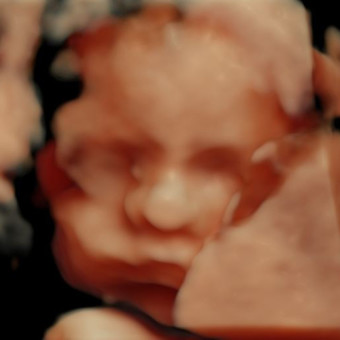 Babylist Registry Photo.