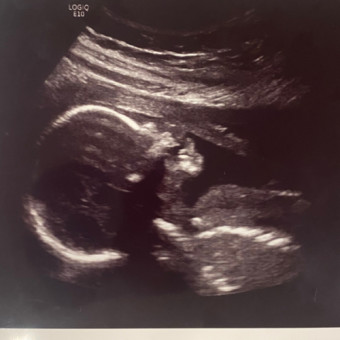 Babylist Registry Photo.