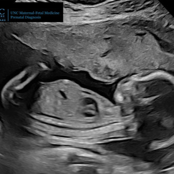 Babylist Registry Photo.