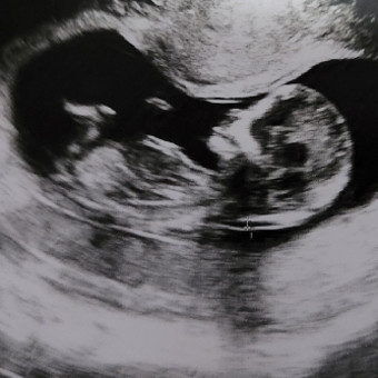 Babylist Registry Photo.