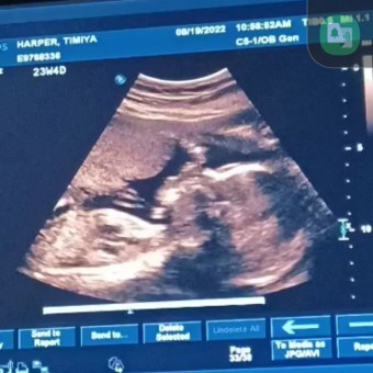 Babylist Registry Photo.