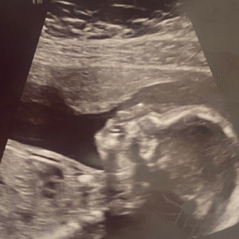 Babylist Registry Photo.