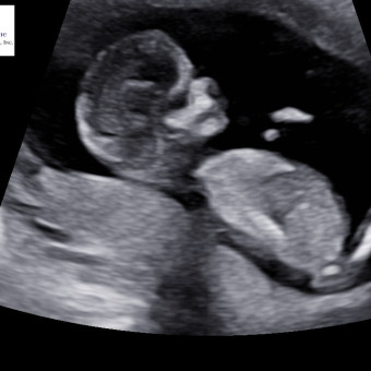 Babylist Registry Photo.