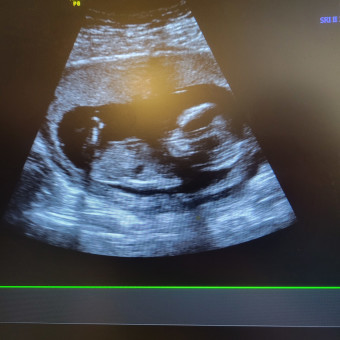 Babylist Registry Photo.