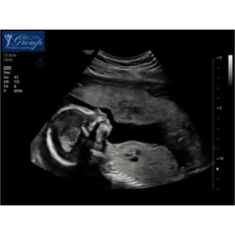 Babylist Registry Photo.