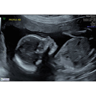 Babylist Registry Photo.