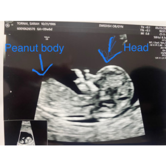 Babylist Registry Photo.