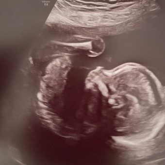 Babylist Registry Photo.