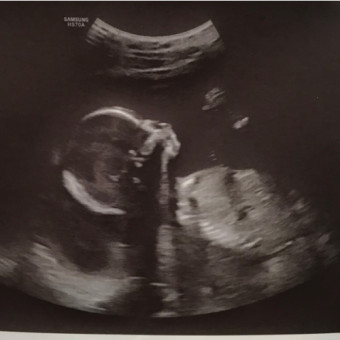 Babylist Registry Photo.