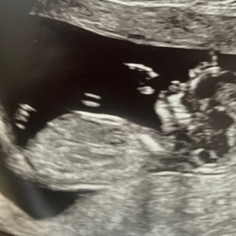 Babylist Registry Photo.
