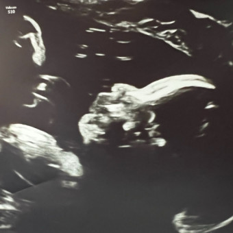 Babylist Registry Photo.