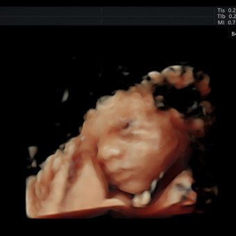 Babylist Registry Photo.