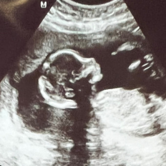 Babylist Registry Photo.