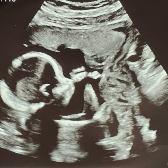 Babylist Registry Photo.