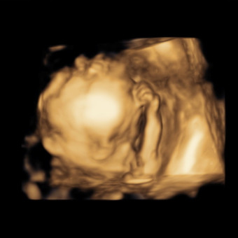 Babylist Registry Photo.
