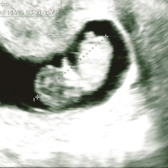Babylist Registry Photo.