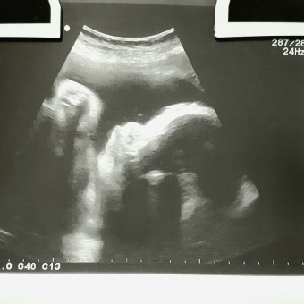 Babylist Registry Photo.