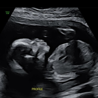 Babylist Registry Photo.