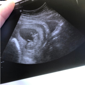 Babylist Registry Photo.