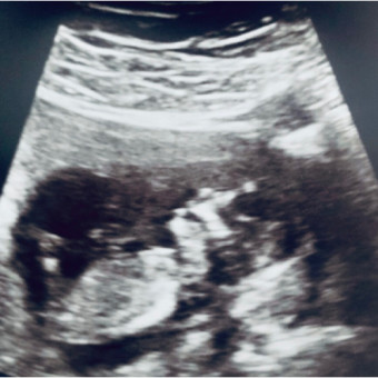 Babylist Registry Photo.