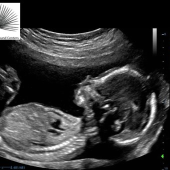 Babylist Registry Photo.