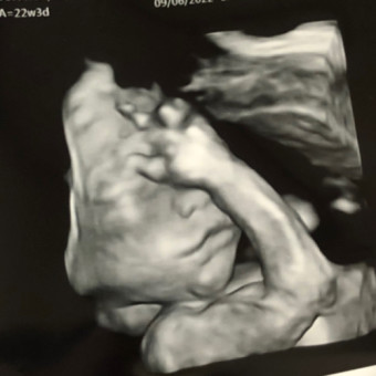 Babylist Registry Photo.