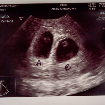 Babylist Registry Photo.