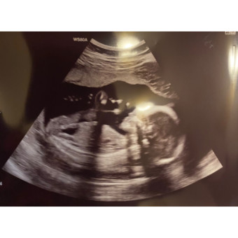 Babylist Registry Photo.