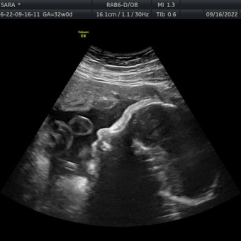 Babylist Registry Photo.