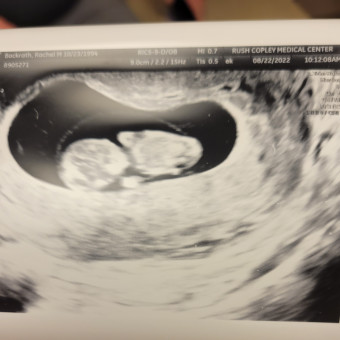 Babylist Registry Photo.